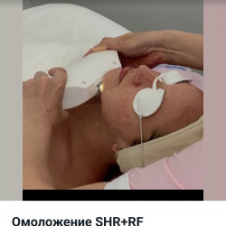 10.Омоложение SHR/RF