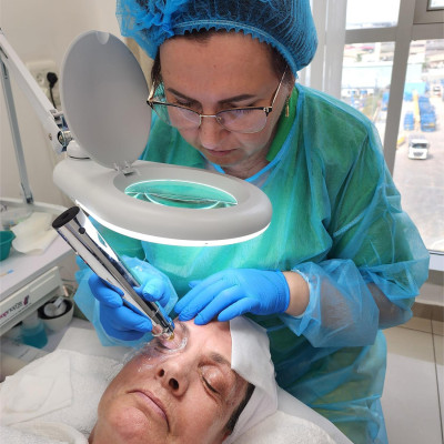 Плазменное удаление папиллом на аппарате Luxus Plasma Liner