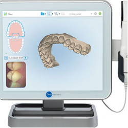 12.Цифровая стоматология в Тбилиси - сканирование зубов