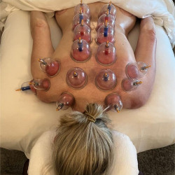 06.Массаж банками - улучшение лимфотока и упругости кожи